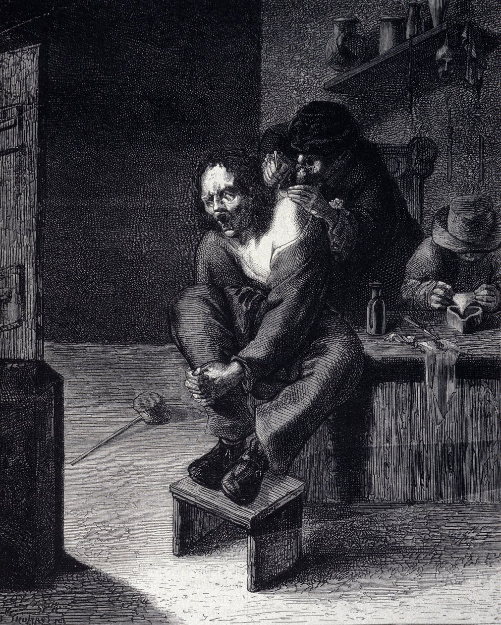 Cerrahi operasyon Adrien Brauwer'in (1608'de yaptı) bir tablosundan sonraki gravür 17. yüzyıl by Adriaen (after) Brouwer
