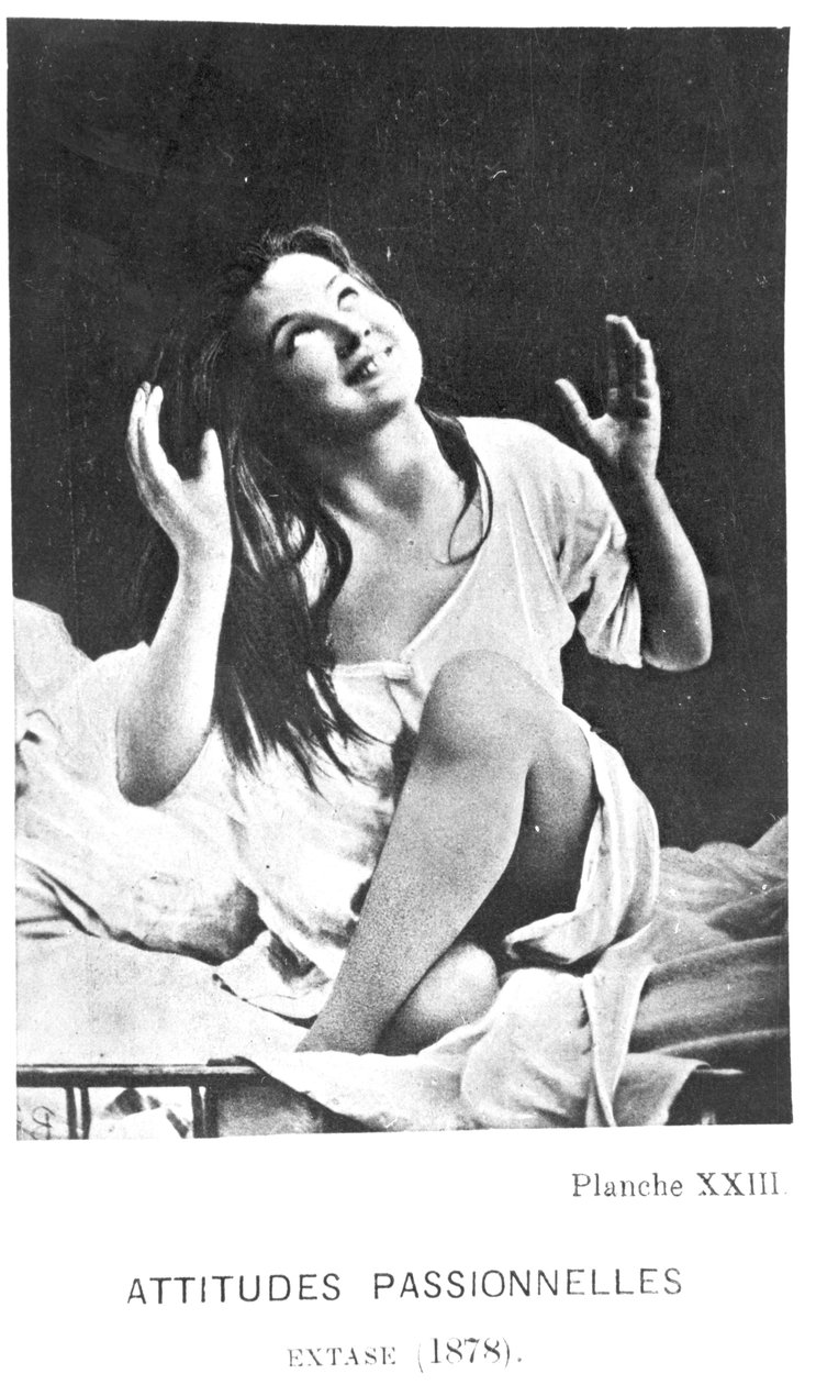 Tutkulu Tutumlar: Desire Magloire Bourneville (1840-1909) ve Paul Regnard (1850-1927) 1878 tarafından yazılan 'Iconographie de la Salpetriere'den coşku içinde Augustine by Albert Londe