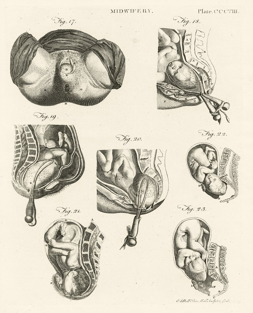 Ebelik, 'Britannica Ansiklopedisi'nden bir örnek, Edinburgh'da yayınlandı, 1798 (bakır levha gravürü) by Alexander Bell