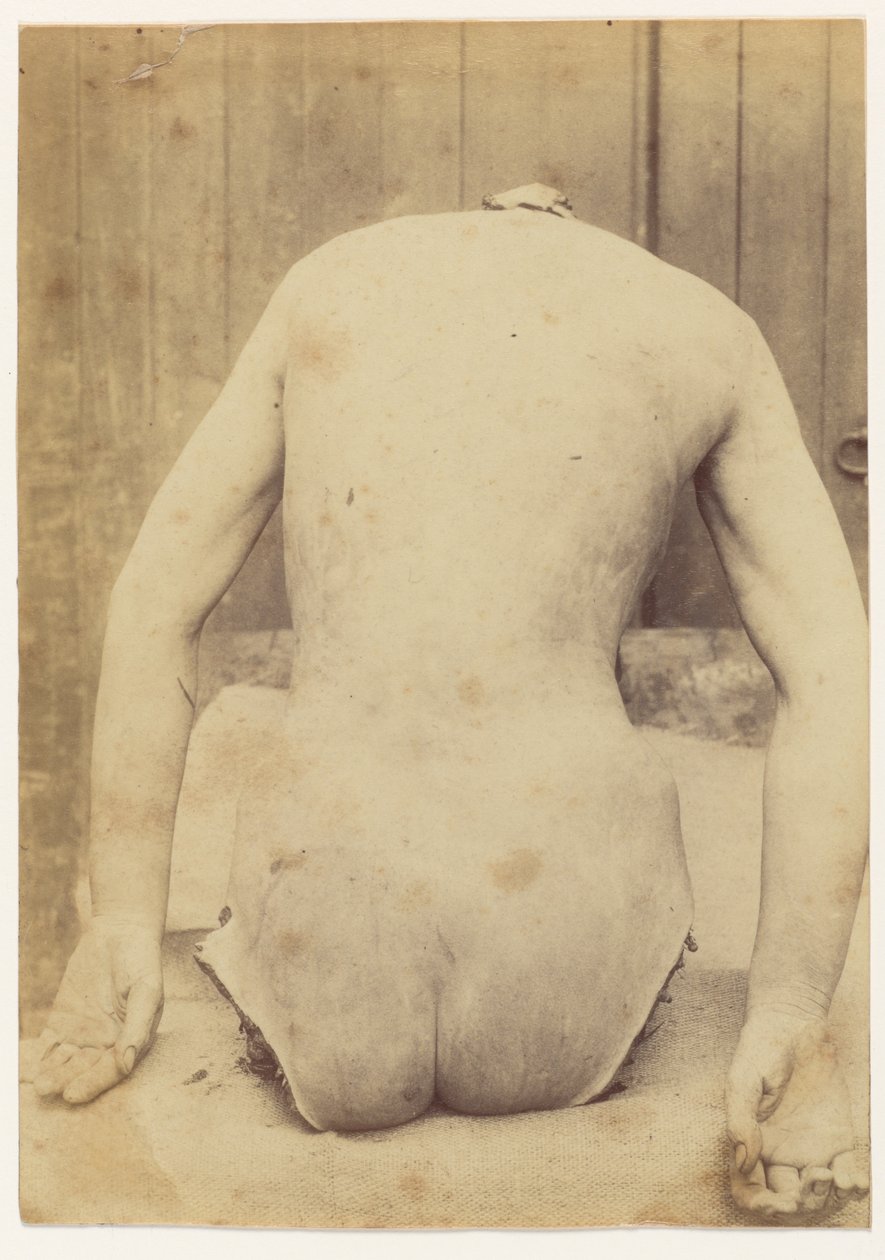  by Alphonse Bertillon