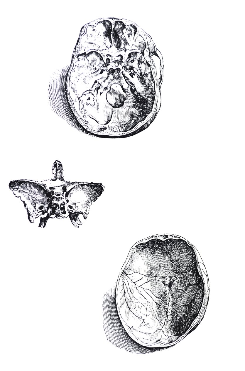 De Humani Corporis Fabrica