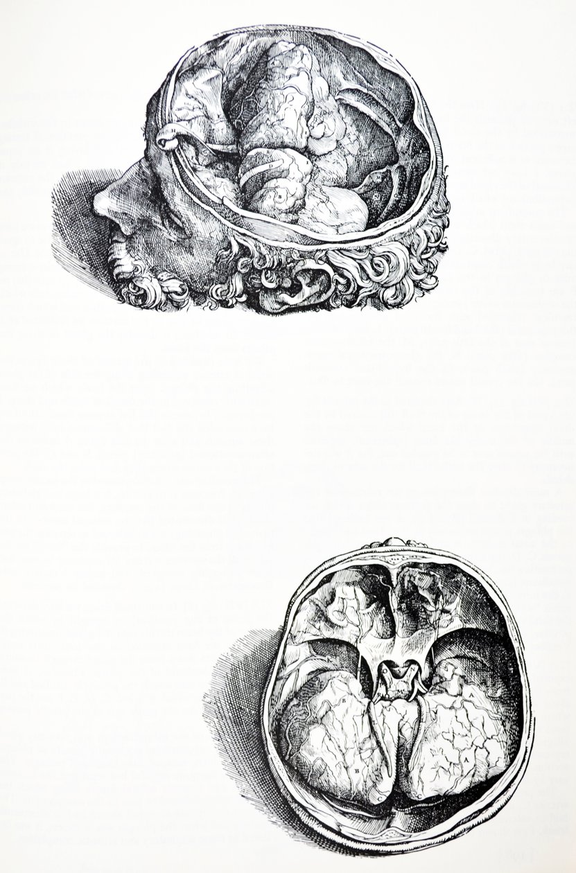 De Humani Corporis Fabrica
