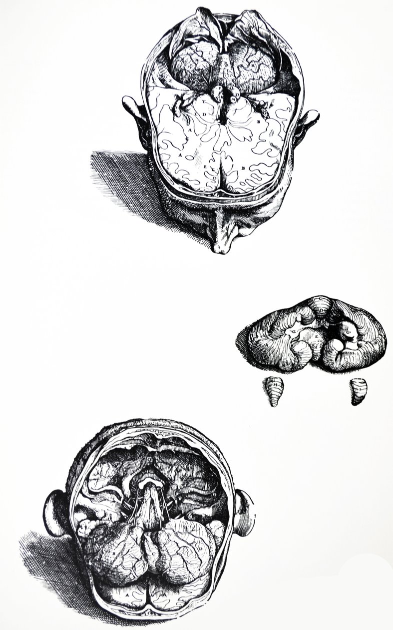 The Plates from the Seventh Book of the De Humani Corporis Fabrica by Andreas Vesalius