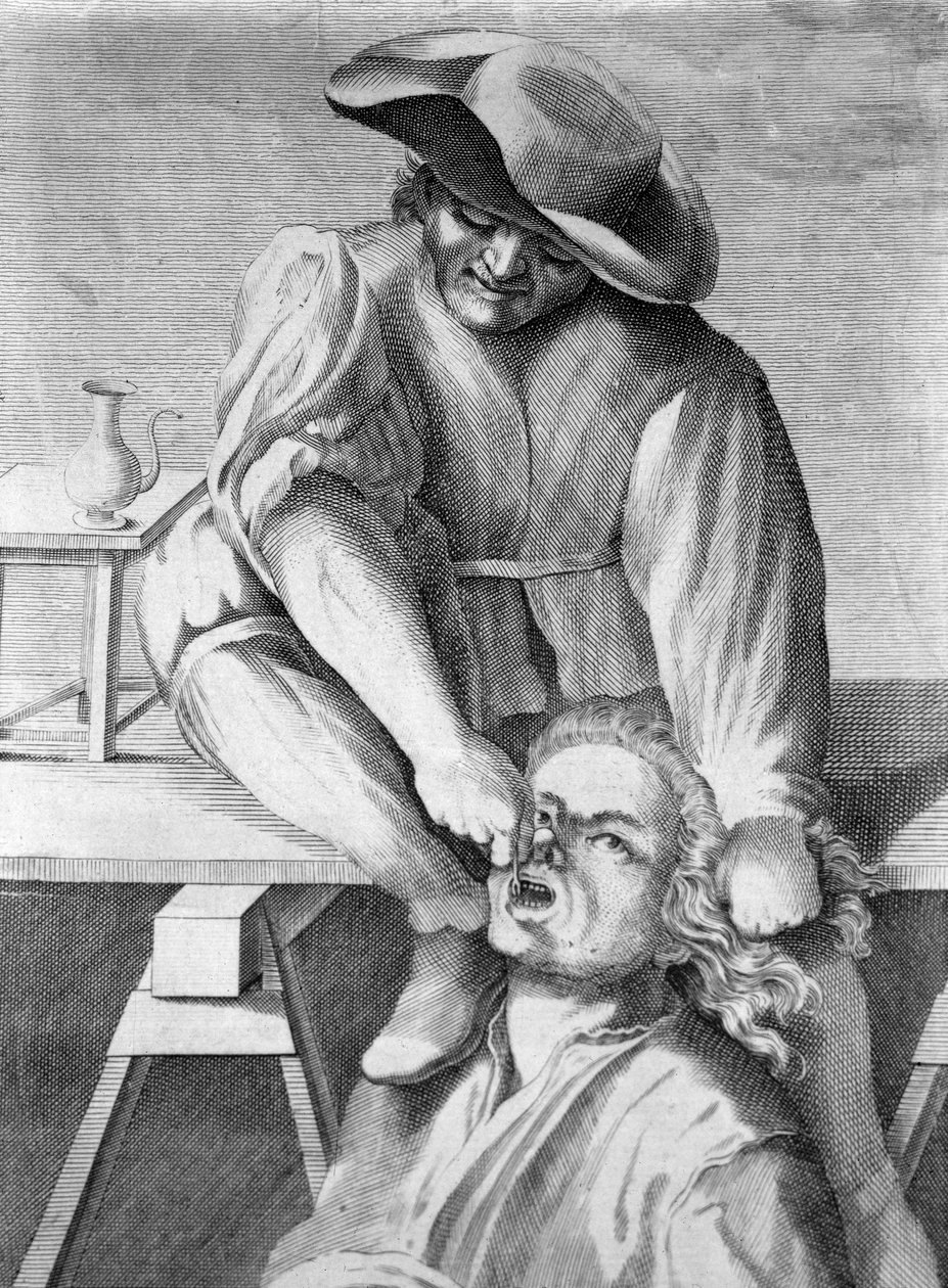 Diş çektirmesi (gravür, 18. yüzyıl) by Anonymous Anonymous