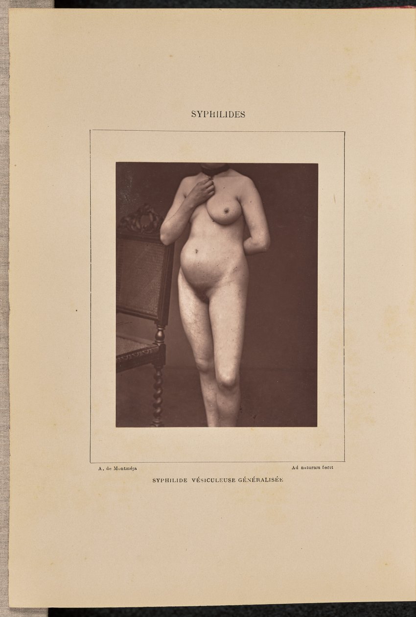  by Arthur de Montmeja