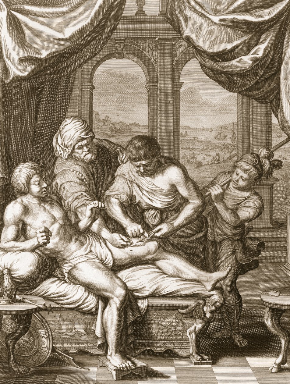 Kendisini Yaralayan Aynı Mızrağın Pasıyla İyileşen Telephus, 1731 by Bernard Picart