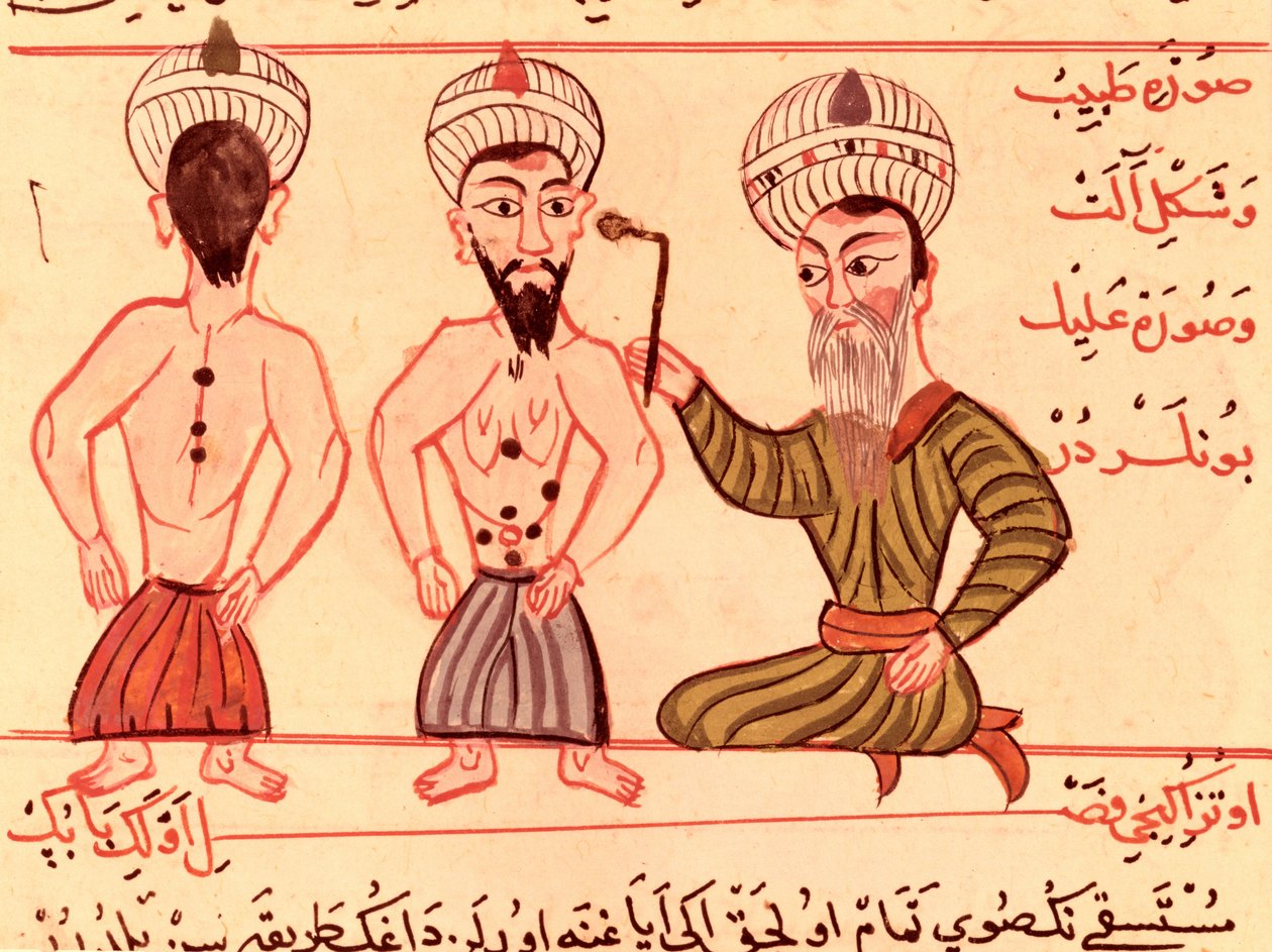 Ms Sup Turc 693 fol.35 Koterizasyon Operasyonu, 1466 by Charaf ed Din