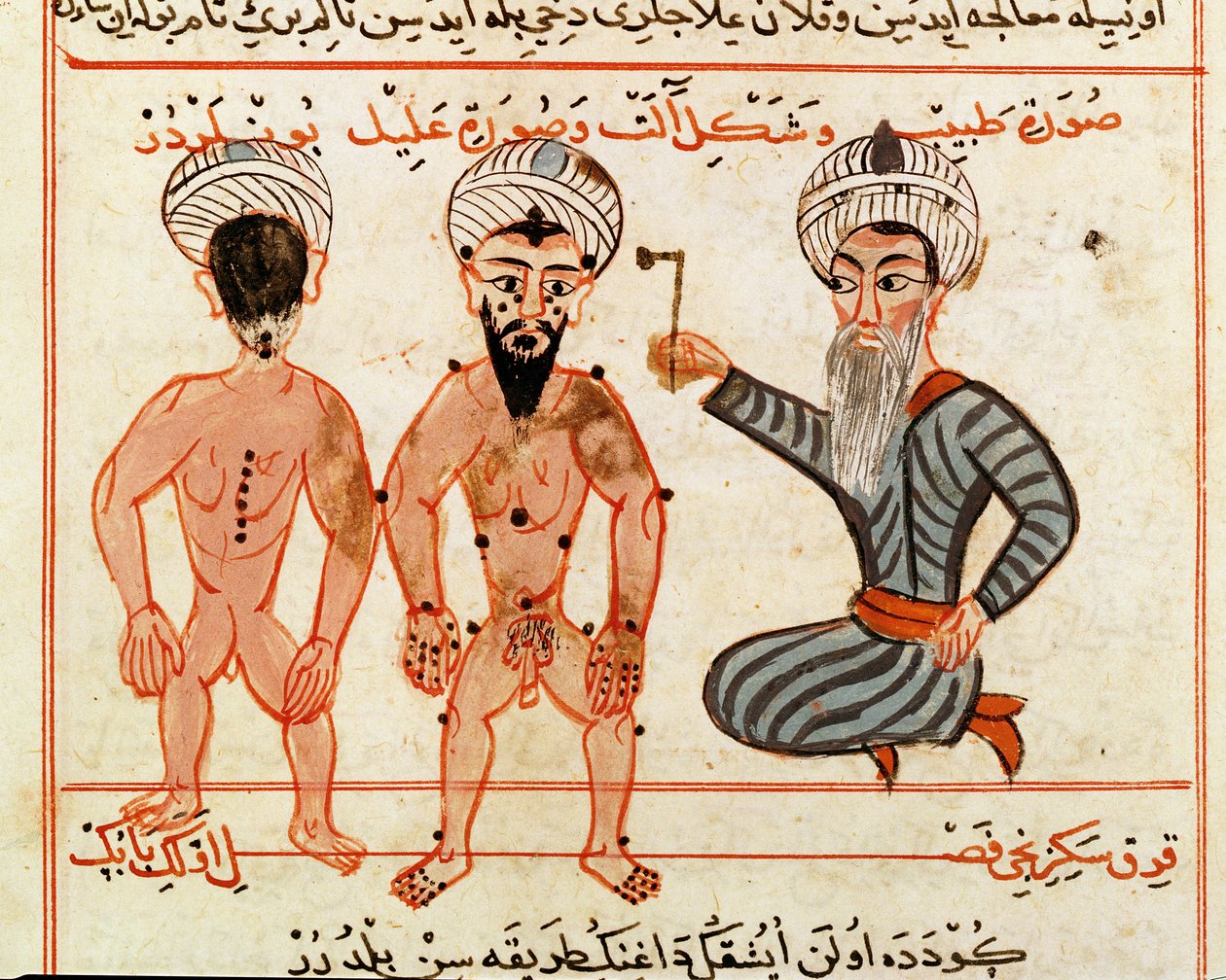 Ms Sup Turc 693 fol.46v Lepra lezyonlarının koterizasyonu, 1466 by Charaf ed Din