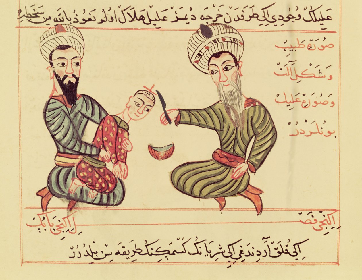 Ms Sup Turc 693 fol.53 Bir çocuğun kafasından biriken sıvının boşaltılması,1466 by Charaf ed Din