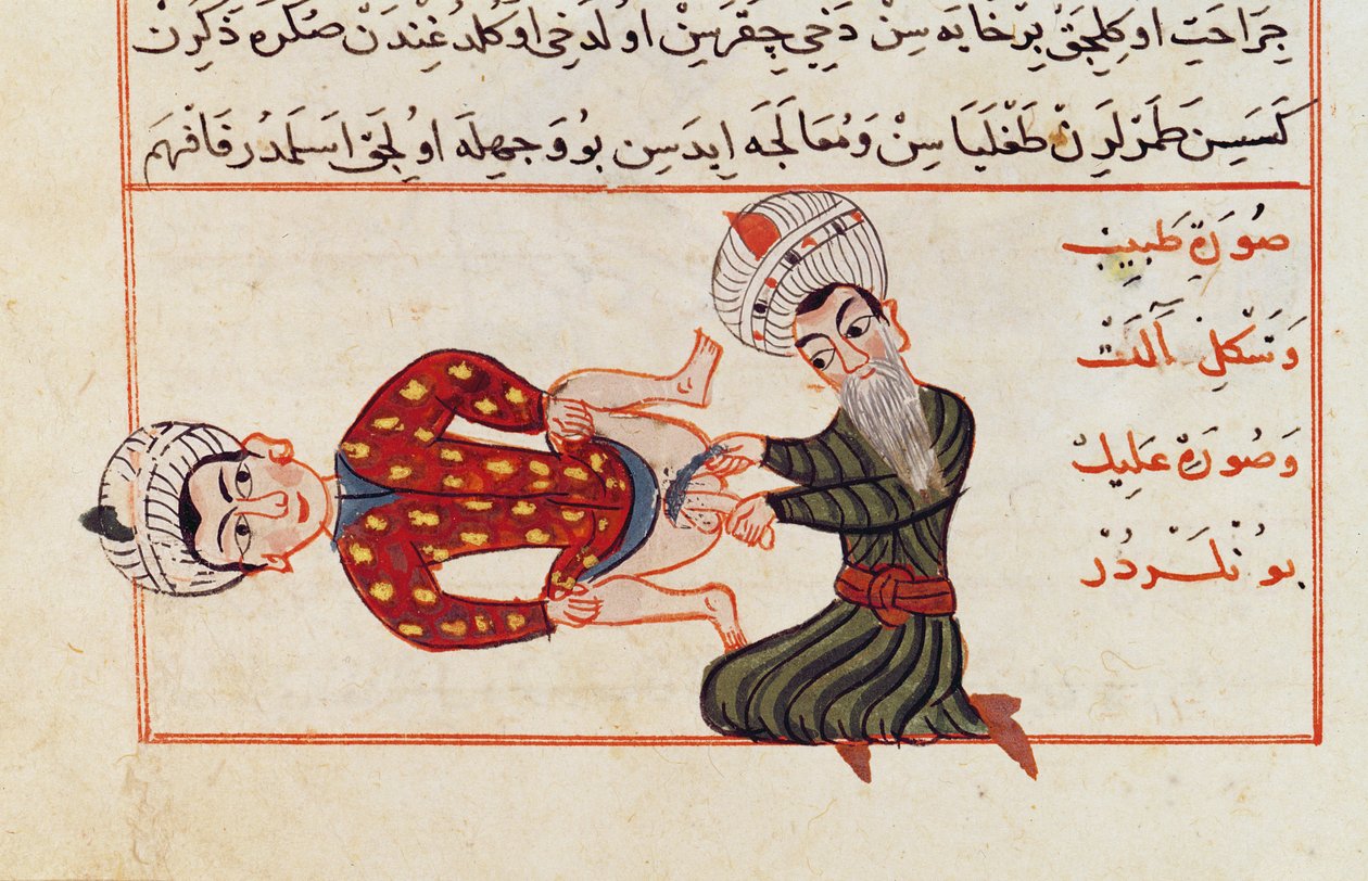 Ms Sup Turc 693 fol.76v Kastrasyon Operasyonu, 1466 by Charaf ed Din