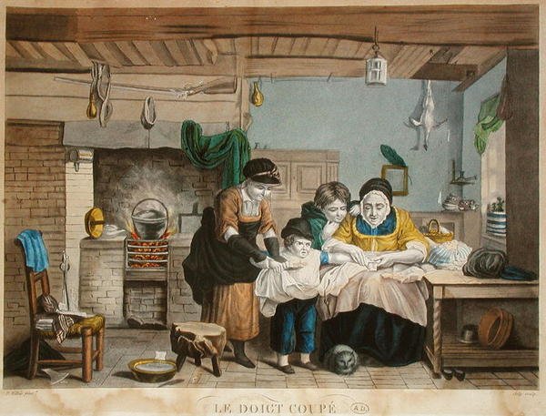 Kesik Parmak, Joly tarafından oyulmuş, c.1830-40 (renkli gravür) by David (after) Wilkie