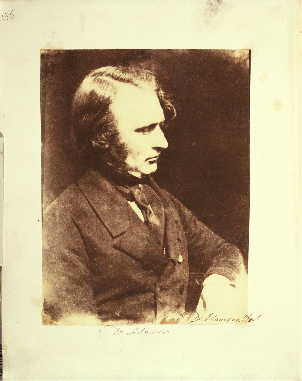 otoportre by Dr. John Adamson