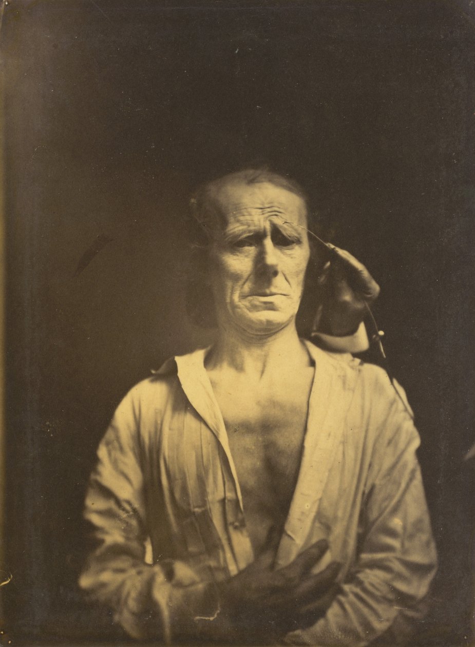 m spazmı çok güçlü ışık altında corrugator supercilii kaldı, Rahat bir yüz..., 1854-1855. by Duchenne de Boulogne