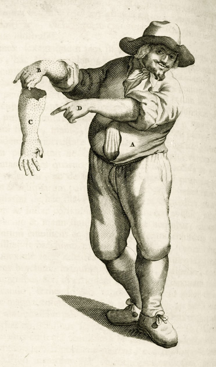 Frederik Dekkers tarafından Tıbbi Yöntemlerde Pratik Egzersizlerden püstüllerle ölü derinin çıkarılması, 1694 by Dutch School