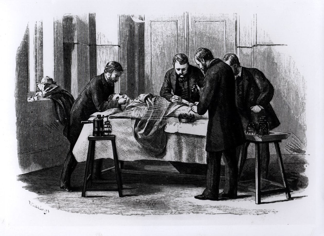 Antiseptik Cerrahi, 1882 by English School