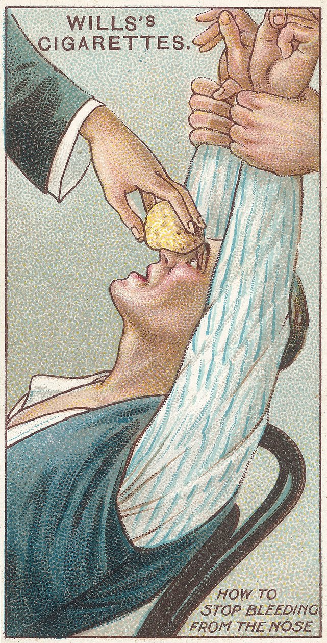 Burundan Kanama Nasıl Durdurulur, No.31 Willss Cigarettes İlkyardım serisi kartları, 1913 by English School