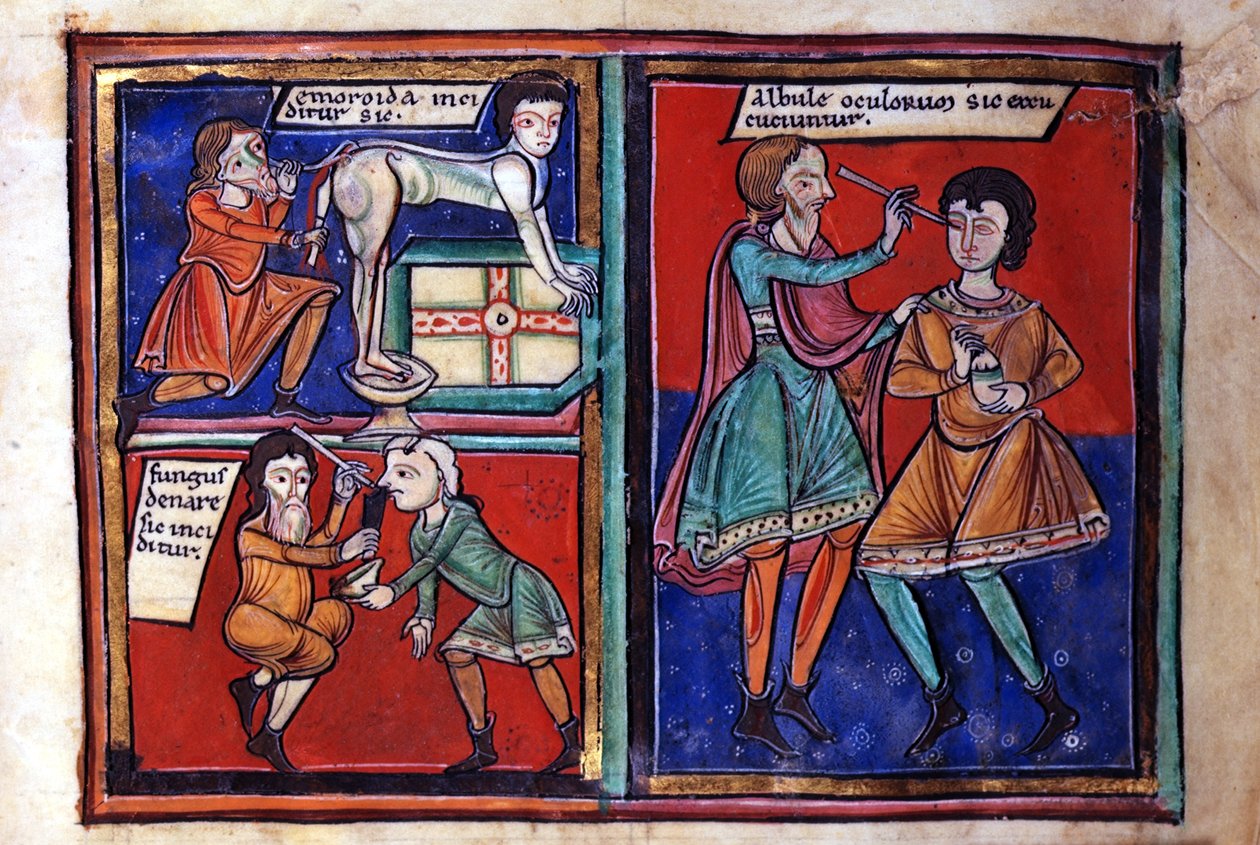 Sloane Ms 1975 fol.93 Tıbbi operasyonlar by English School