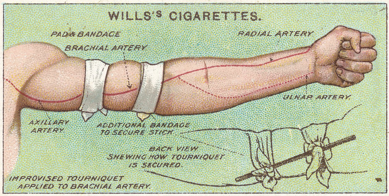 Turnike, No.11 Willss Cigarettes kartlarının İlk Yardım serisinden, 1913 by English School