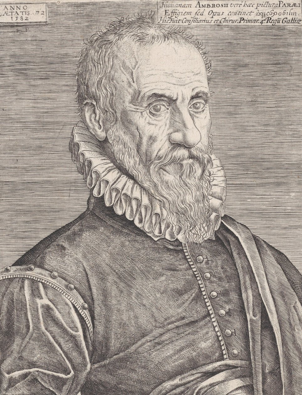 Kralın cerrahı Ambroise Paré