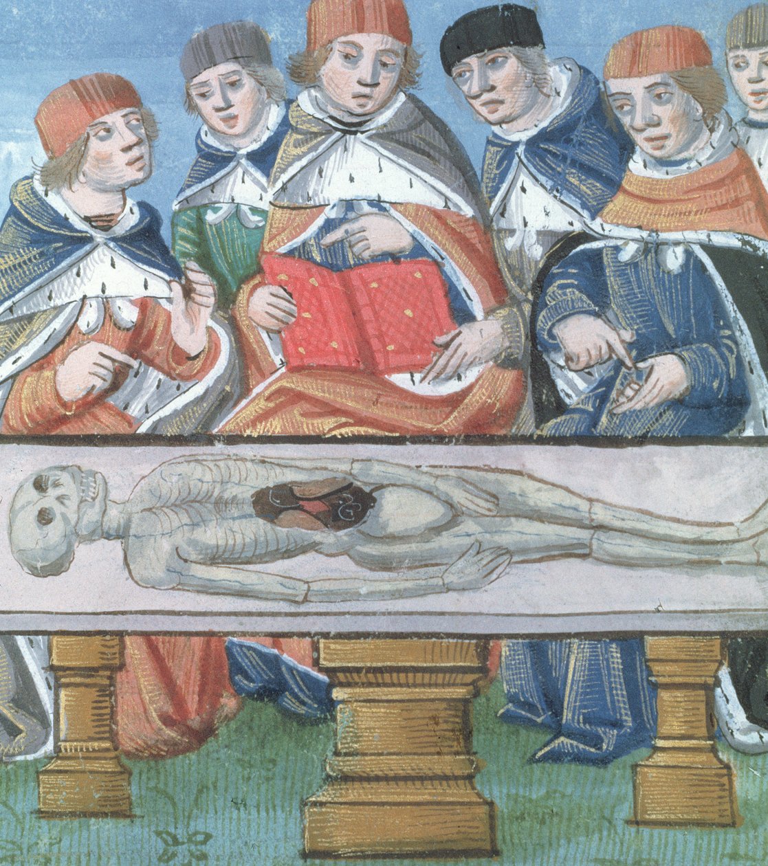 Ms Hunter 9 f.34r Diseksiyon, De Medina Fen I. II
