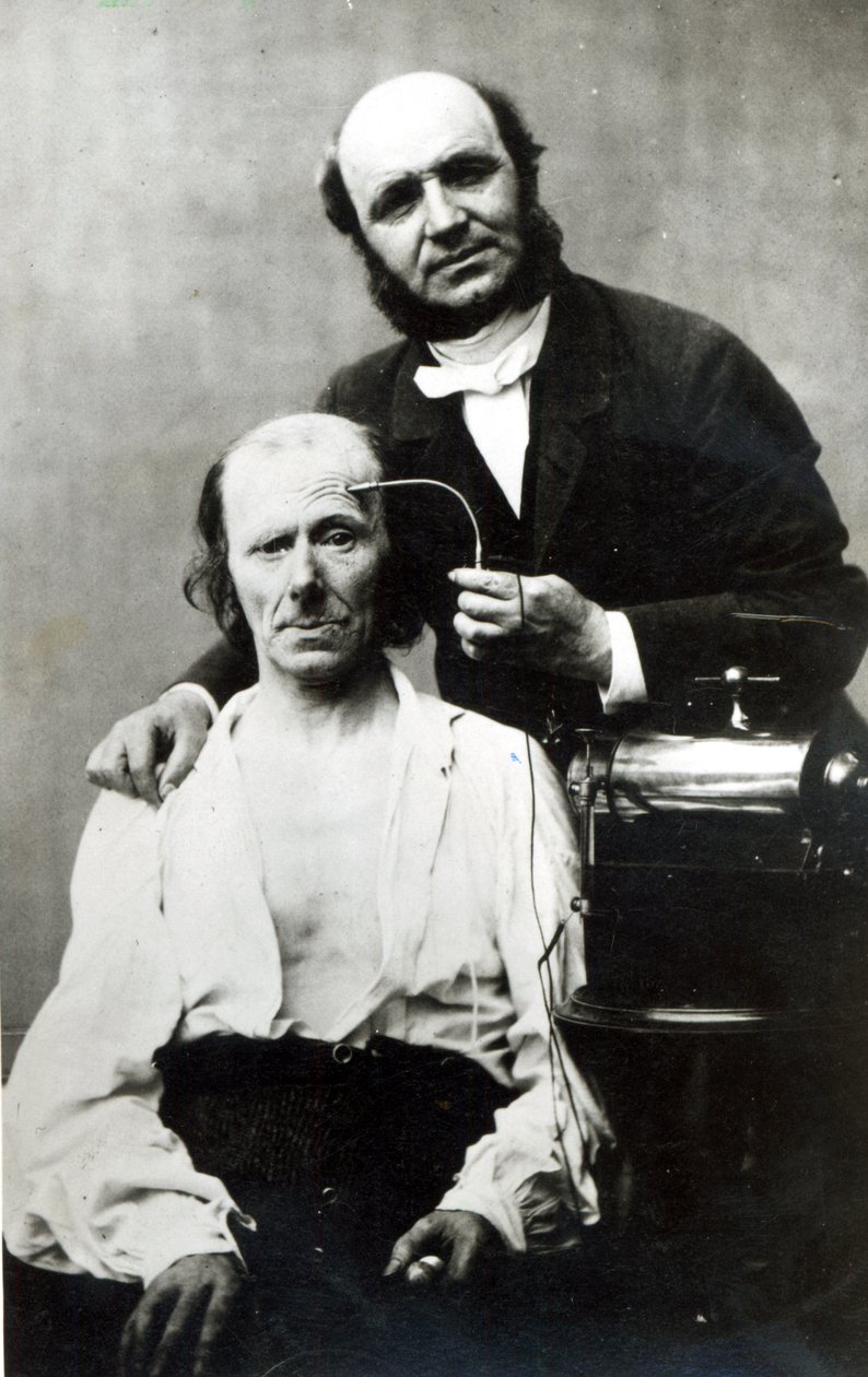 Duchenne de Boulogne, kurban bir hastayla, 1862 by French Photographer