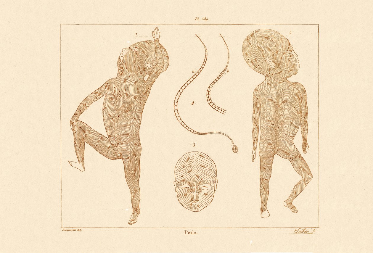 Vücut Kılı, 1833-39 by French School