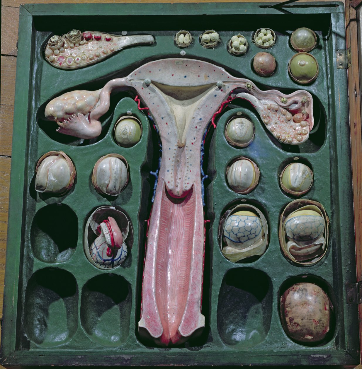 Kadın cinsel organları, c. 1830 (boyalı karton) by French School
