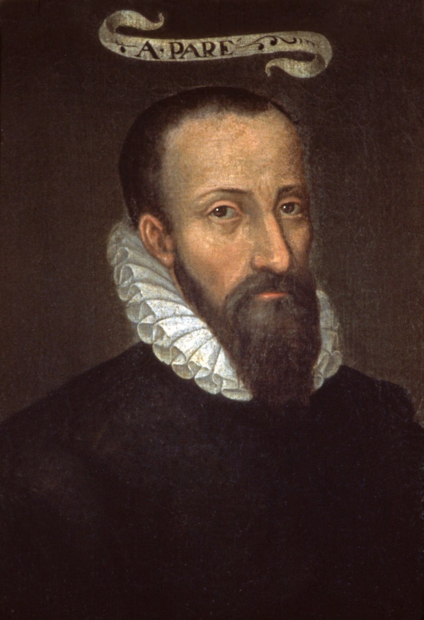 Ambroise Pare. 16. yüzyıl (resim) by French School