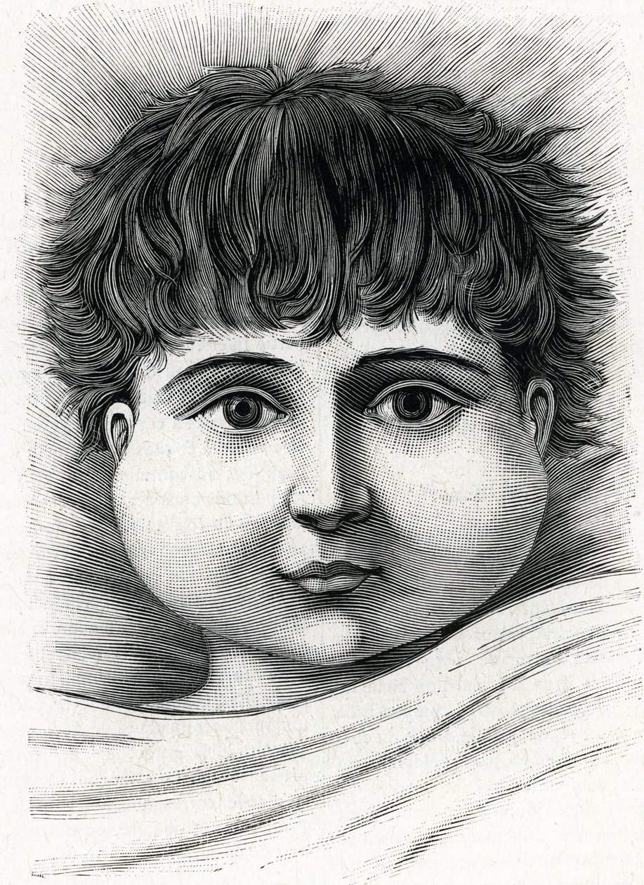 Kabakulak hastalığı olan çocuk (gravür) 1888 by French School