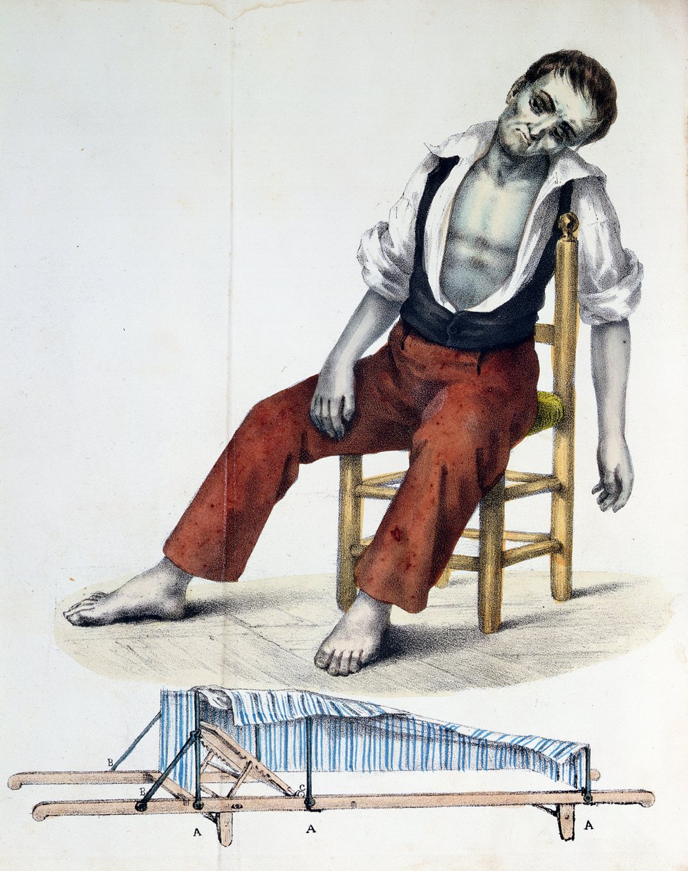 Kolera Morbus, Kolera-Morbus İlişkisi, Tarihi, İstatistikleri ve Tıbbından Francisco dAssis de Souza Vaz, 1833 by French School