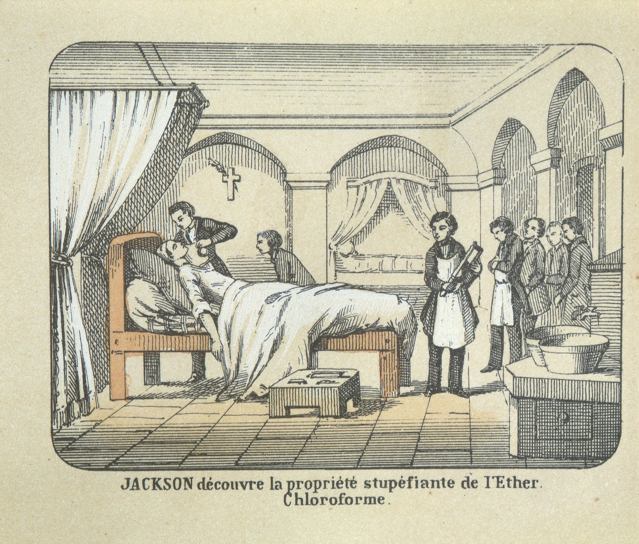 Dr Charles Jackson (1805-80) eterin anestezik niteliklerini keşfeder. by French School