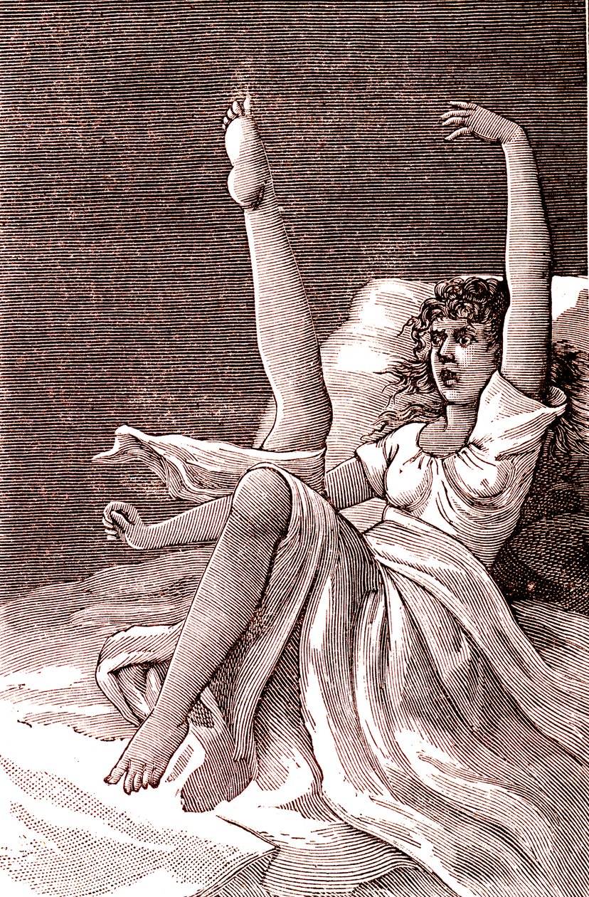 Histeri, son derece zihinsel bir fenomen, psikozlar ve psikonevroz.1887 (gravür) by French School