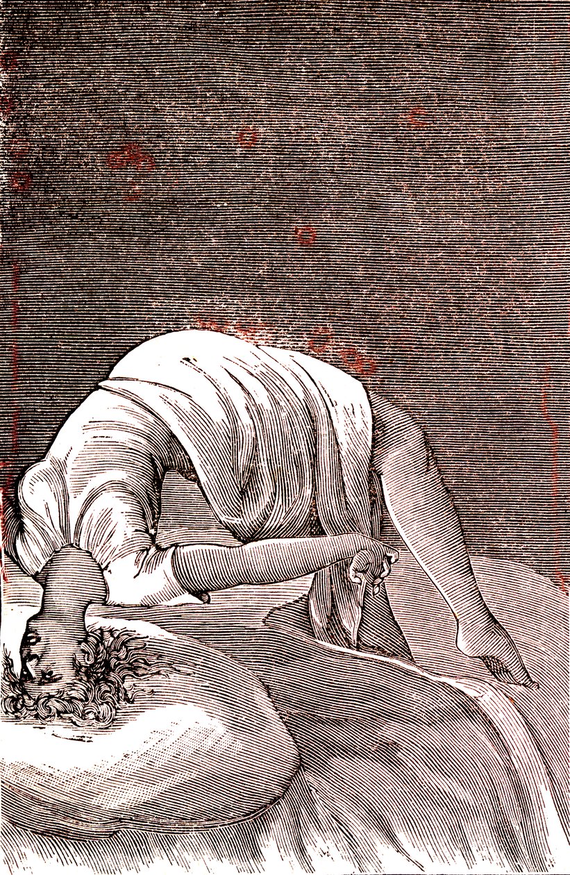 Yoğun kaygıdan kaynaklanan histeri, zihinsel ve sinirsel bozukluk. 1887 (gravür) by French School