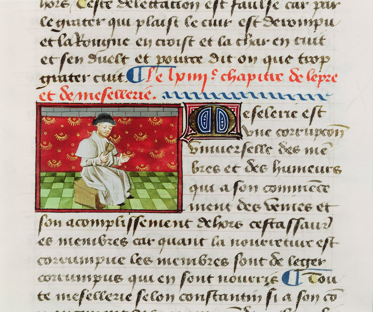 Bayan Fr. 22532 Fol. 118 Leper, Le Livre des Proprietez des Choses, Barthelemy l Anglais tarafından by French School