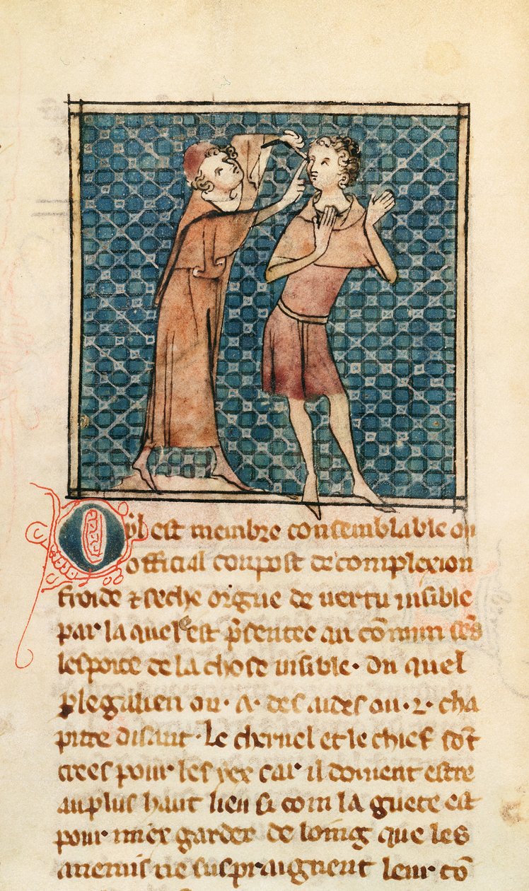 Ms 2030 fol.17 Oftalmoloji, La Chirurgie de Maitre Henri de Mondeville