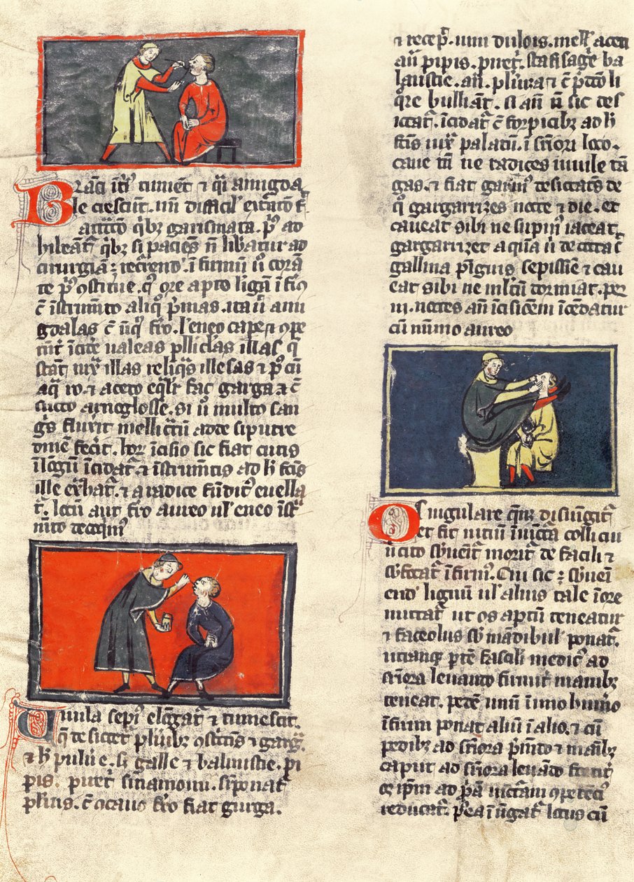 Ms H 89 fol.16v Diş Cerrahisi, Rogier de Salerne