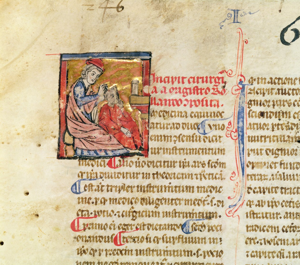 Bayan Lat. 7134 fol. 1 Trepanation, Chirugie de Maitre Rolandi