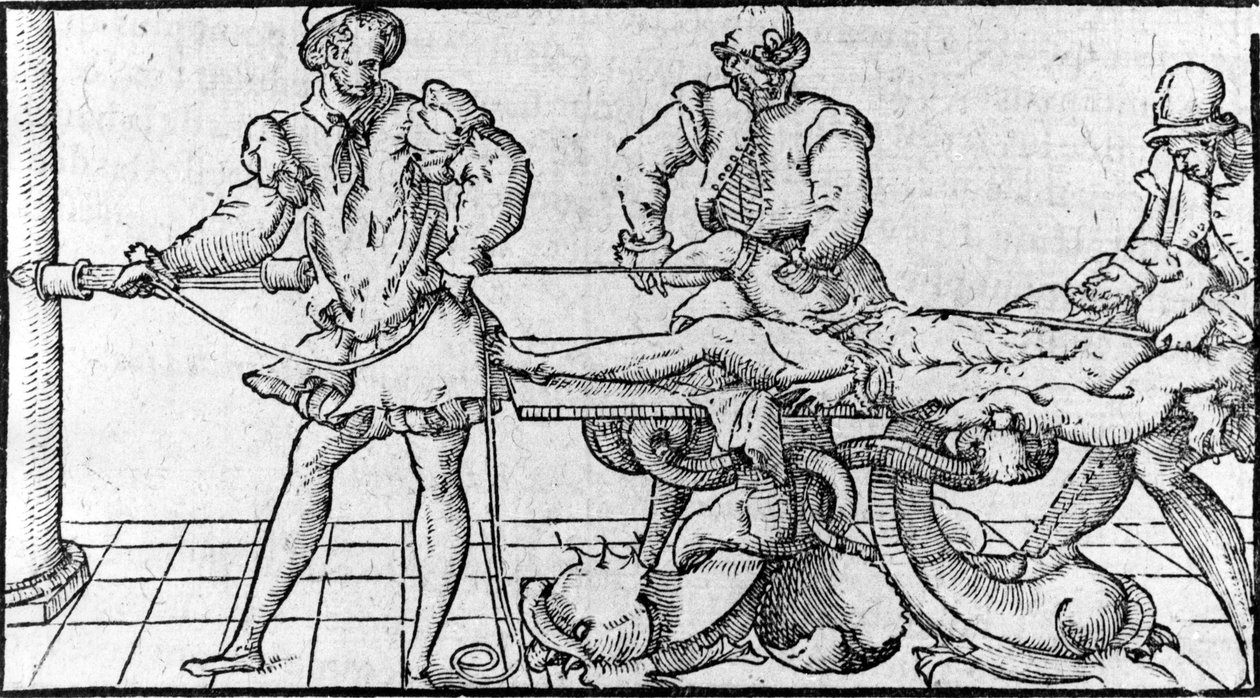 Çıkığın azaltılması, -“Ambroise Paré Tıbbi Antlaşması”nda, yaklaşık 1560. by French School