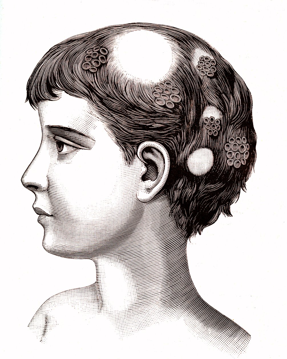 Çocukta saçkıran. 1887 (gravür) by French School