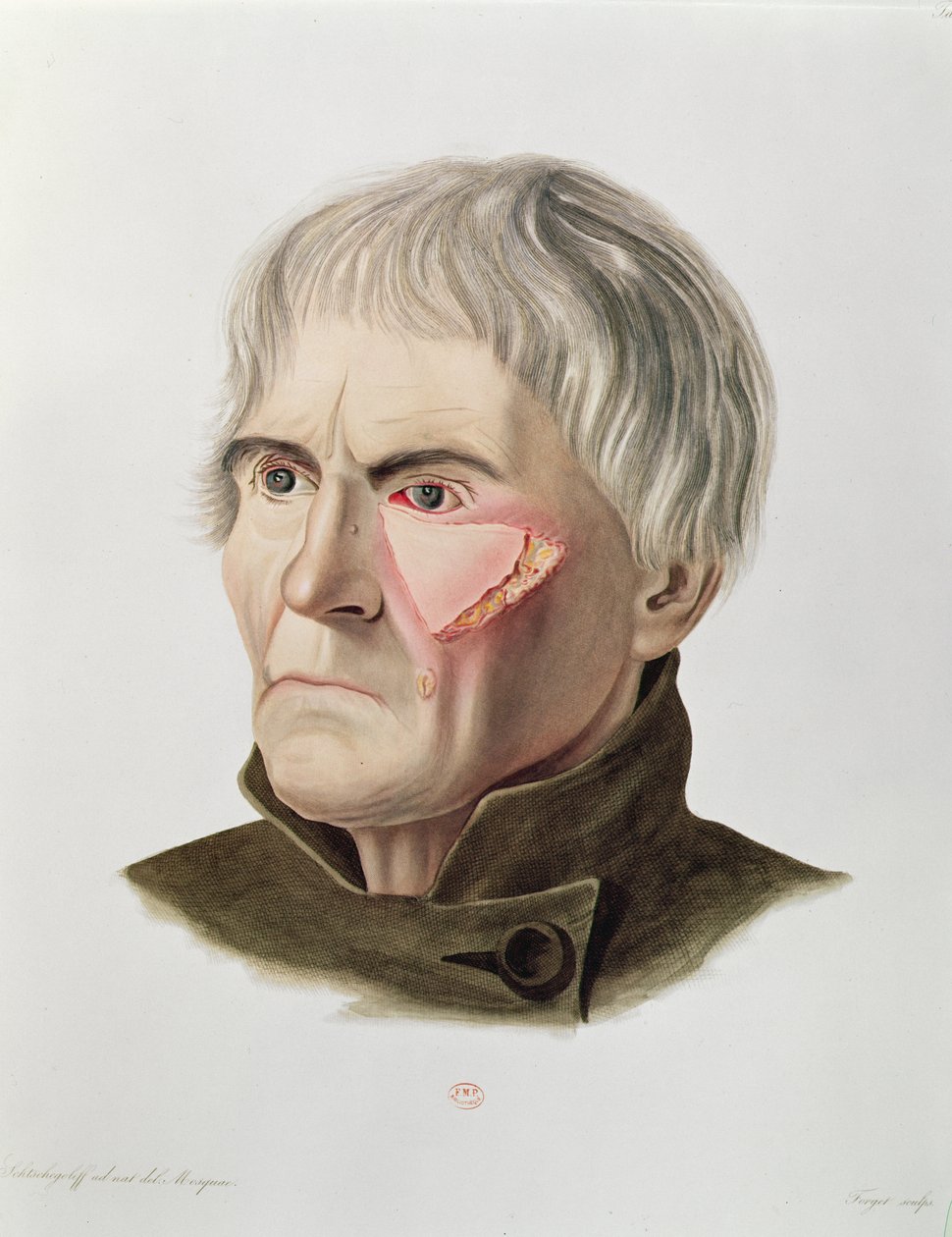 Alexander Auvert, Paris, 1856 tarafından Selecta Praxis Medico-Chirurgica