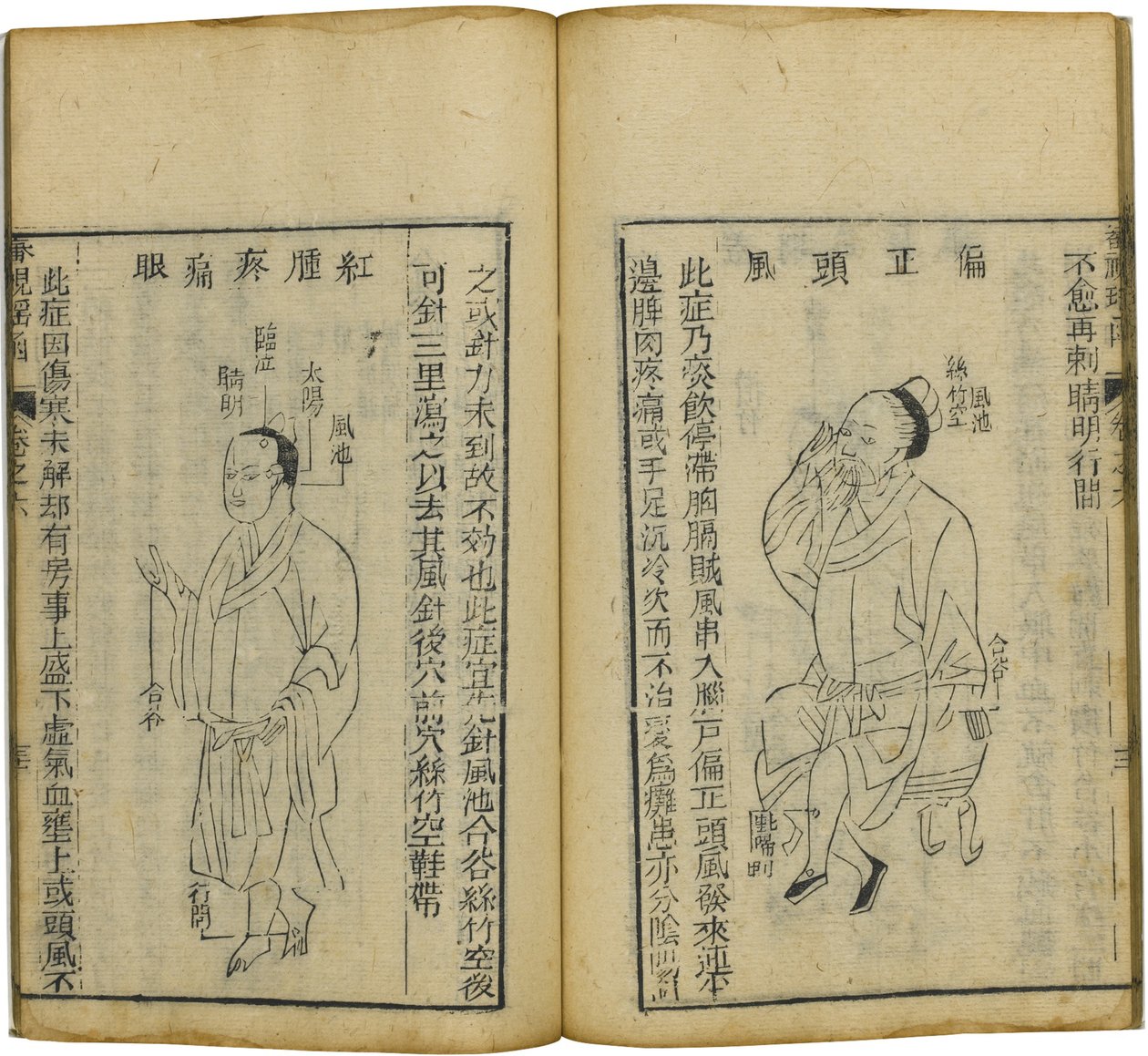 Shen Shi Yao Han Değerli Bir Oftalmoloji Kitabı, 1644 by Fu Renyu