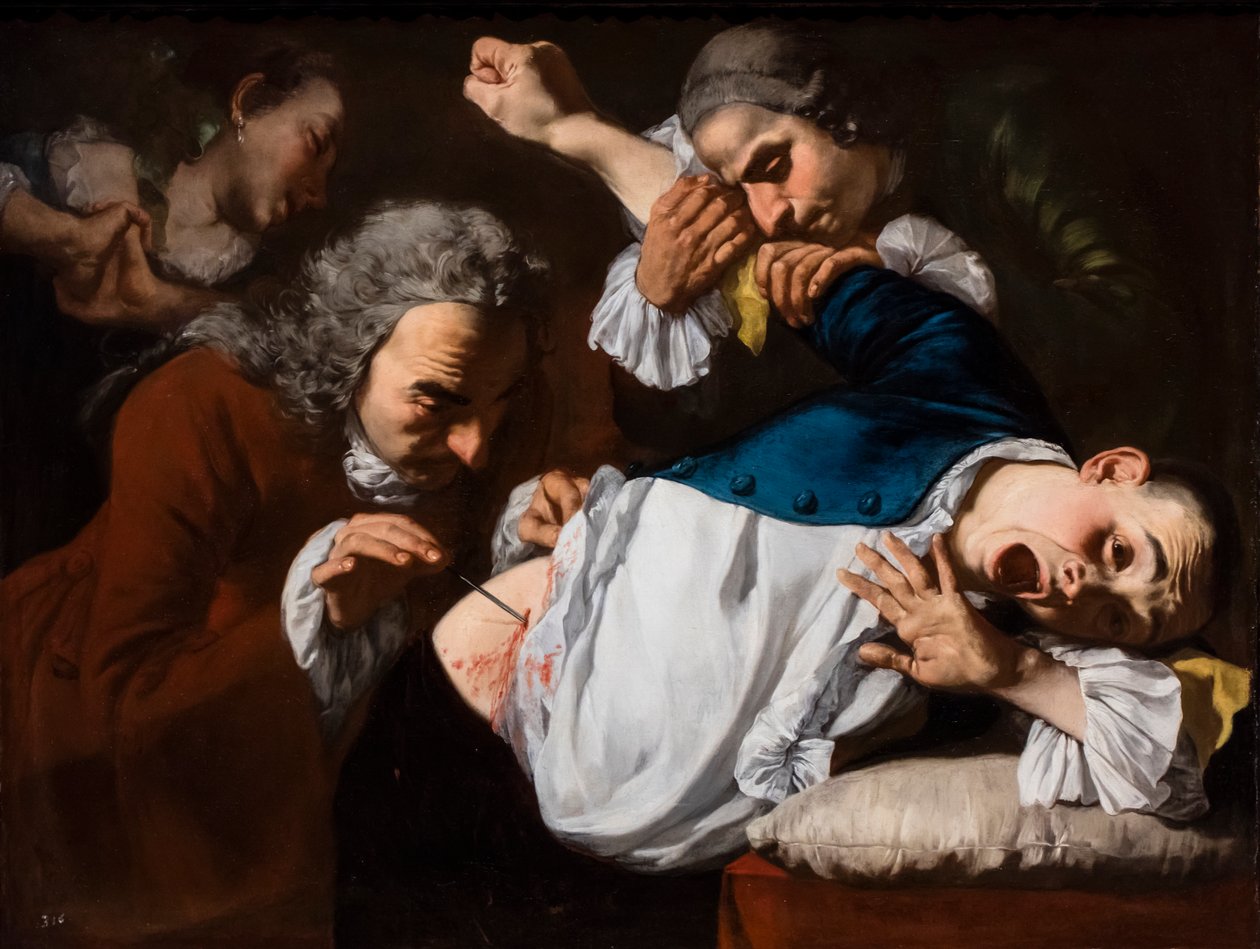 Operasyon, 1753/54 civarı (Tuval üzerine yağlıboya) by Gaspare Traversi