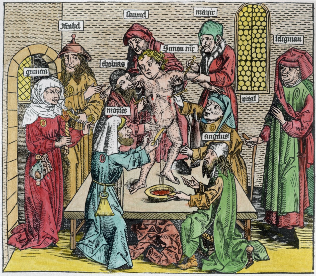 Sünnet, Hartmann Schedel (1440-1514) tarafından 