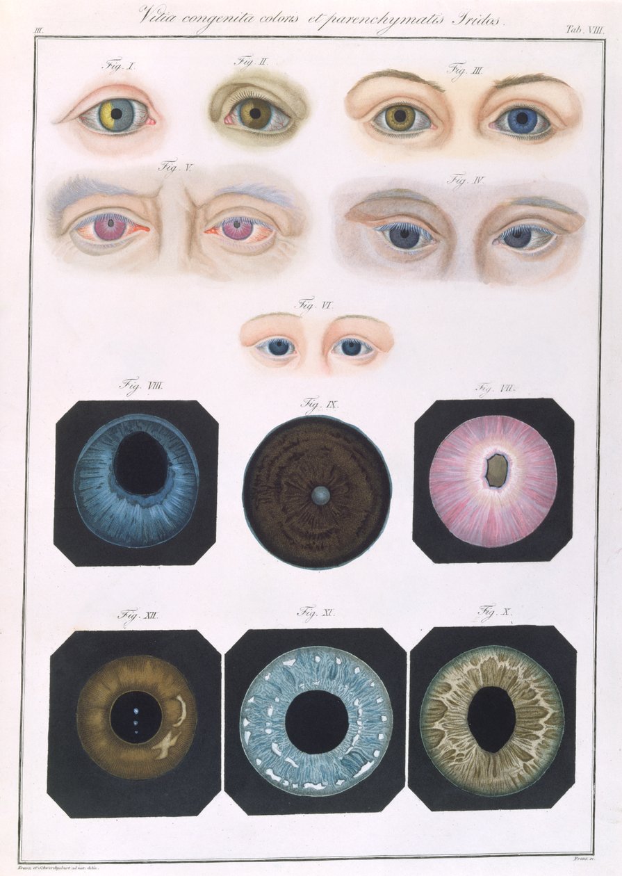 Konjenital göz anomalilerinin tanımı, Friedrich August von Ammon (1799-1861) 1838 tarafından insan gözünün hastalıklarının ve görme kusurlarının klinik tanımlarından by German School