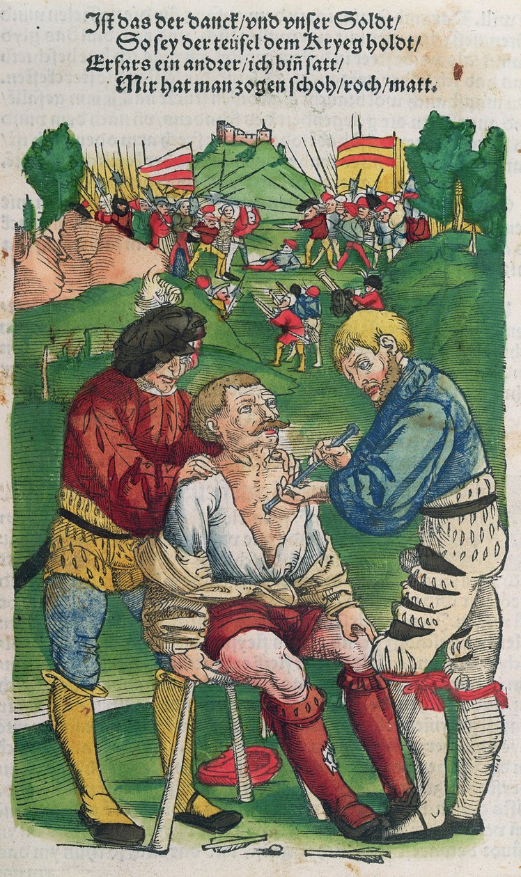 Bir oku kaldırma, Feldtbuch der Wundartzney