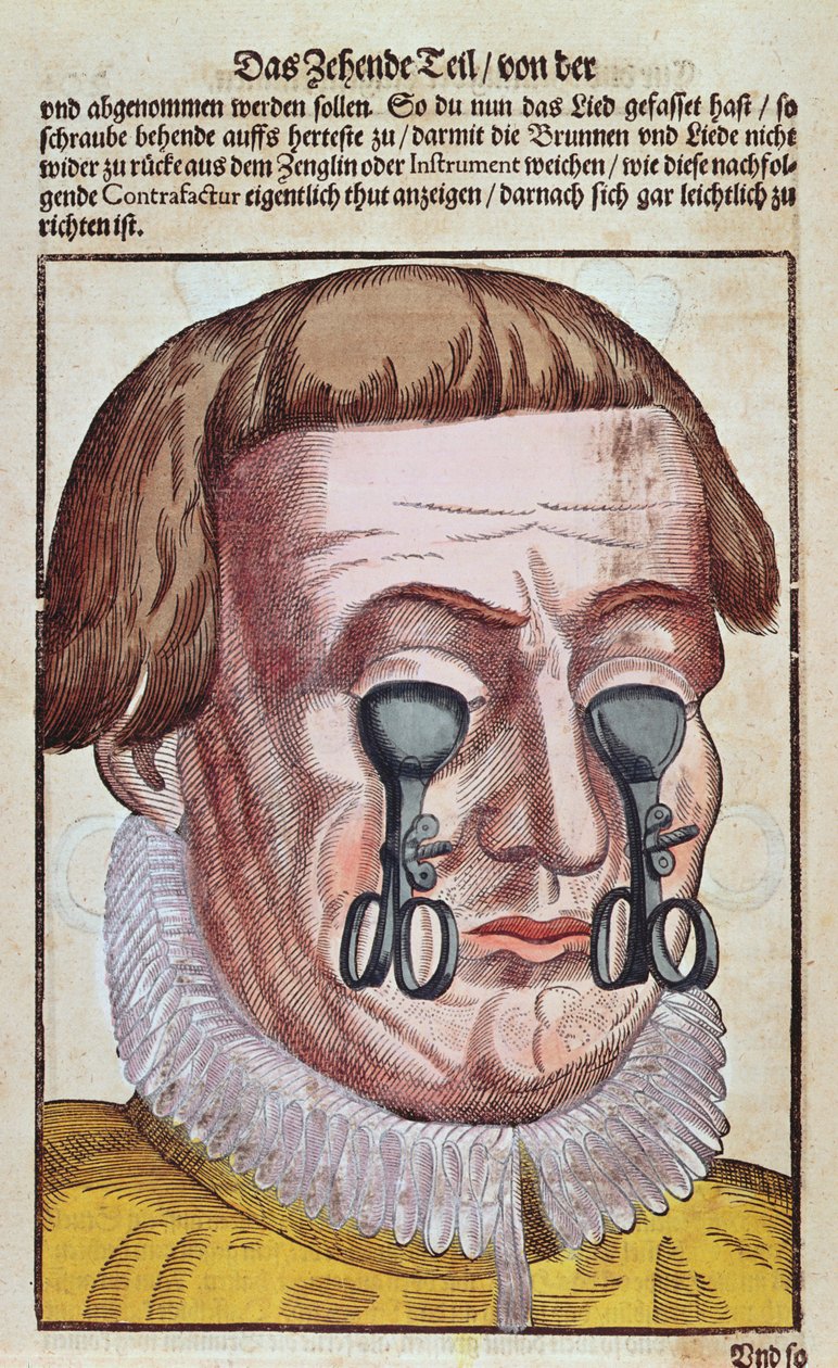 Bir göz rahatsızlığının tedavisi, Georg Bartisch (1535-1636) tarafından Dresden