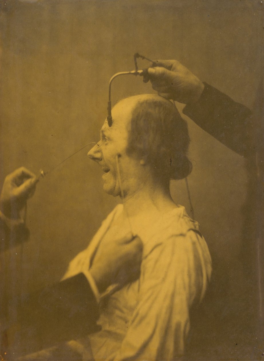  by Guillaume Benjamin Armand Duchenne de Boulogne