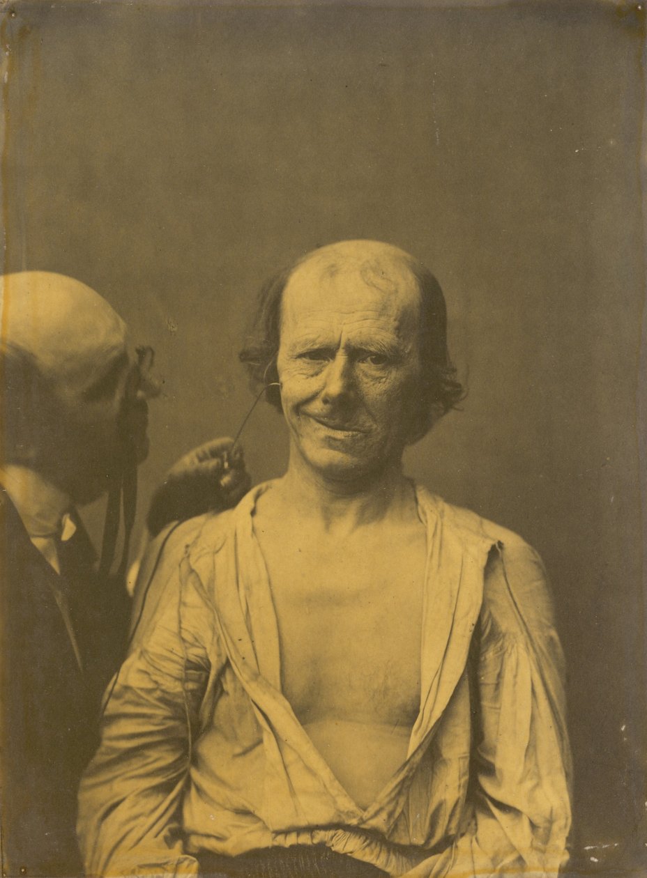 Rahat bir yüz (solda); Sahte sevinç veya kahkaha (sağda) by Guillaume Benjamin Amant Duchenne