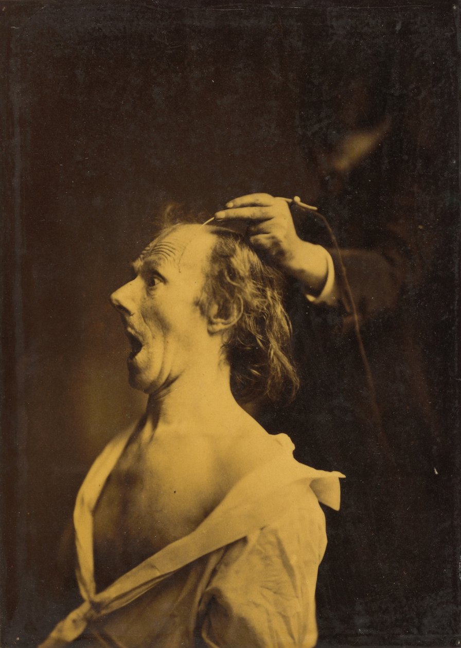 Şaşkınlık, şaşkınlık, hayret by Guillaume Benjamin Amant Duchenne