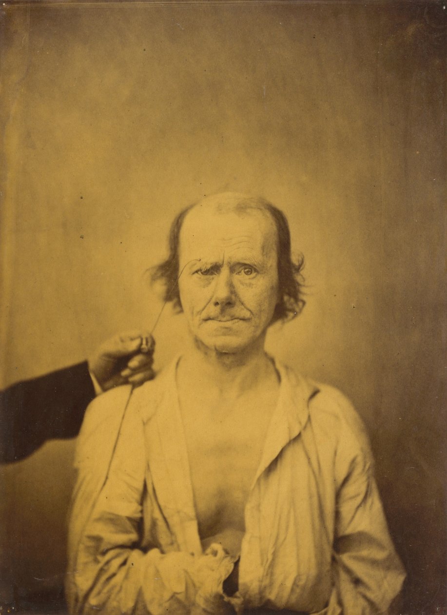 Dikkat (solda); Yansıma (sağda) by Guillaume Benjamin Amant Duchenne